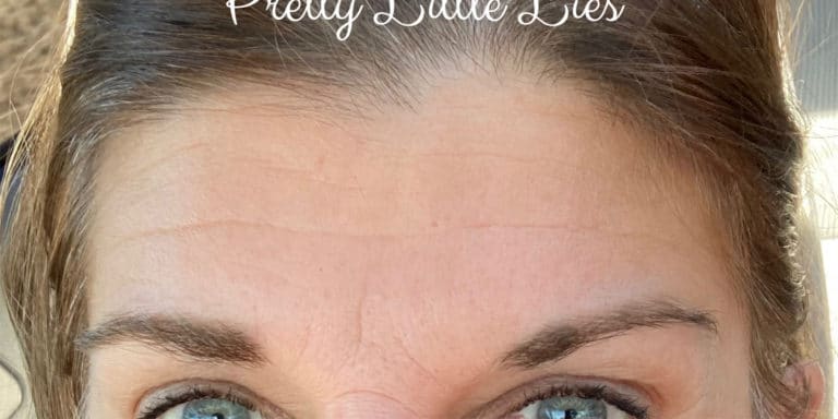 After Image: Botox - front
