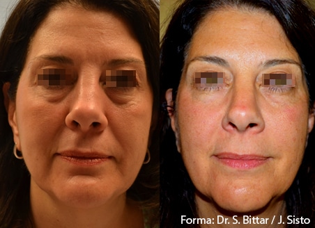 forma before after dr s bittar dr j sisto preview 1 1