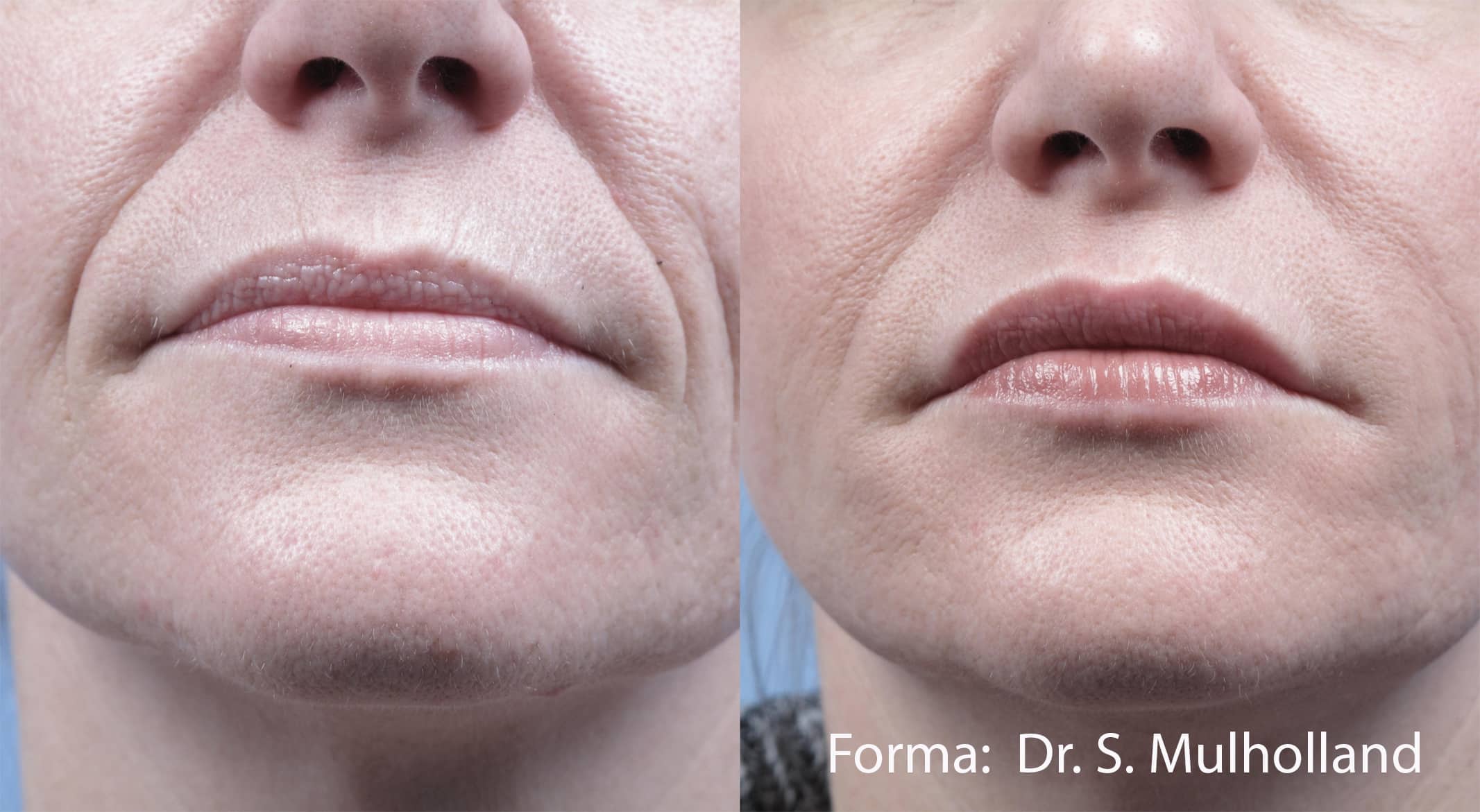 forma before after dr s mulholland preview 2