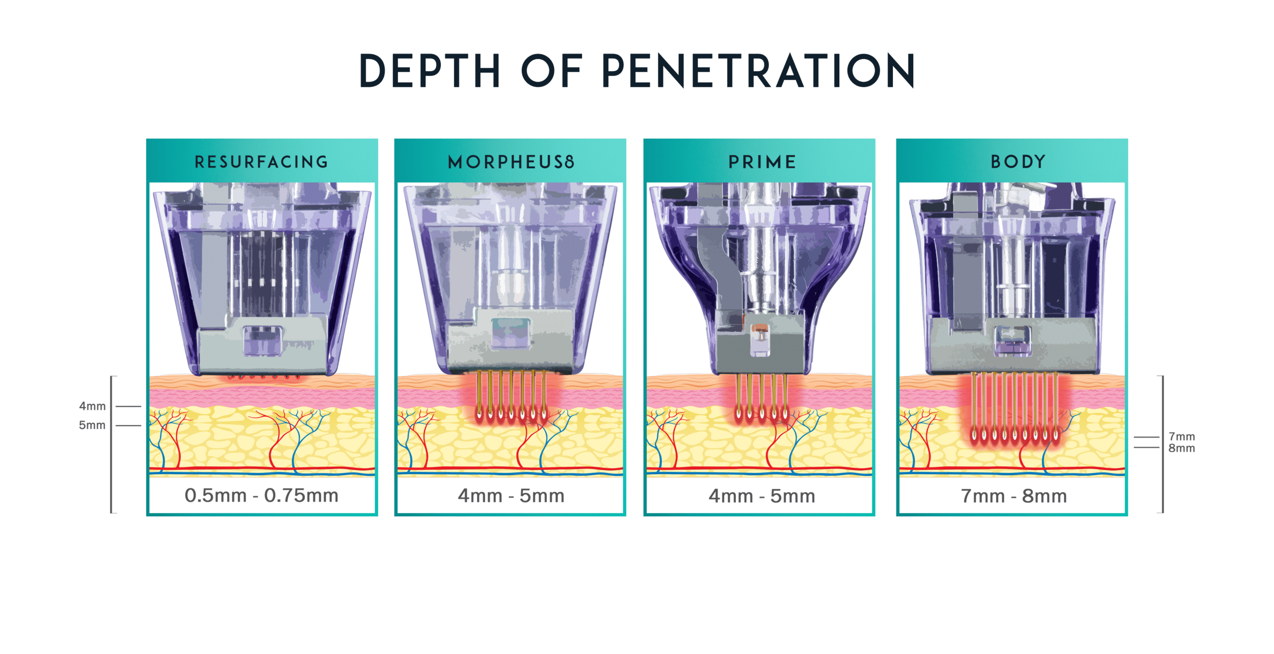 morpheus8 treatment depths graphic preview 1