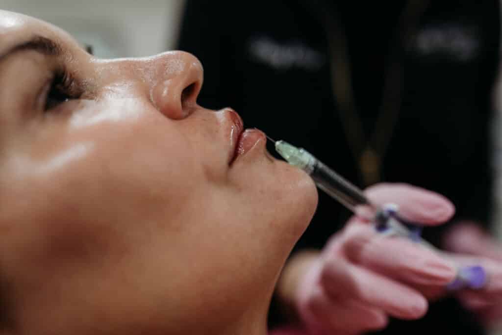 LipFiller