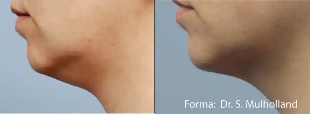 forma-before-after-dr-s-mulholland-preview-3-scaled.jpg